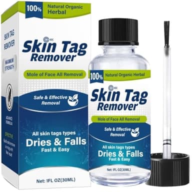 Verruche Rimozione Della Pelle, Verruca, 30ML Effetto Sicuro Della Pelle Tag Remover Verruca Liquido Trattamento Per Adulti Mani Viso Bambini a Casa